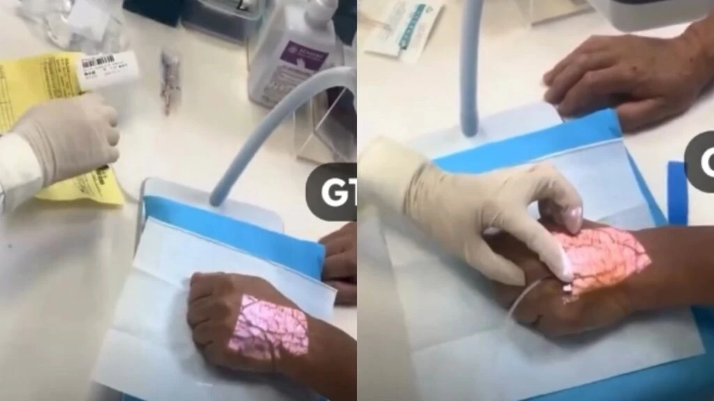 Teknologi medis canggih China mempermudah pemasangan infus dan pengambilan darah dengan sensor pintar dan robotik presisi tinggi